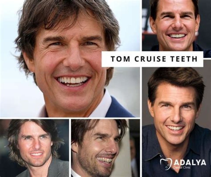 Tom Cruise Teeth Before And After / 3 Grazia Pagnotto
