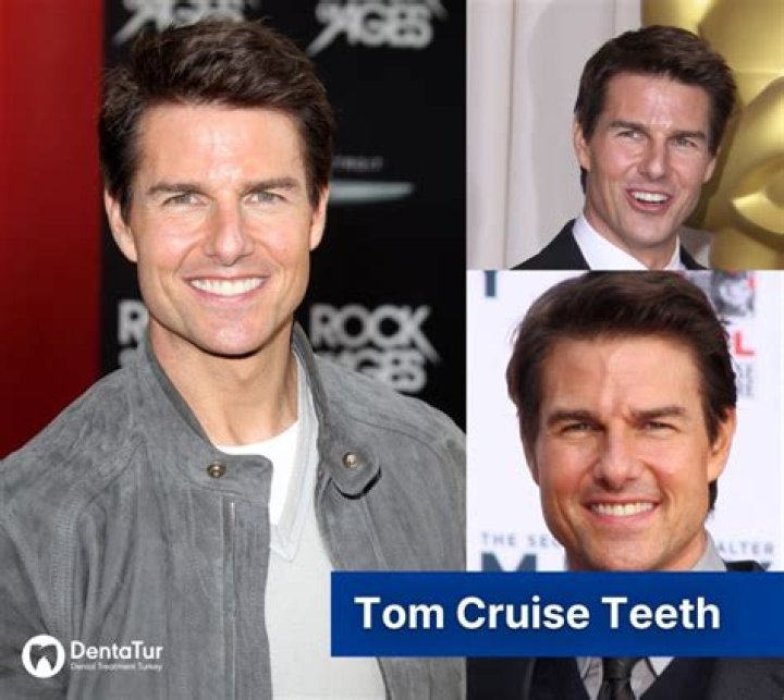 Tom Cruise Teeth The Truth About The Actor's Distinctive Misaligned