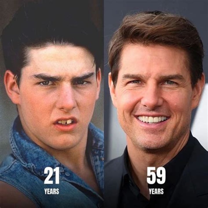 Tom Cruise The Outsiders Teeth