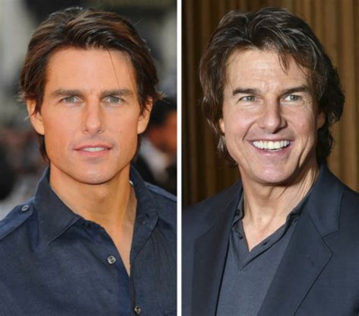 Tom Cruise&rsquo;s Shocking Teeth in The Outsiders Still Haunt Fans Today