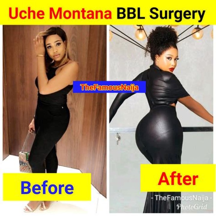 Tommie Lee Before Surgery BBL Tommiee Before And After Fame Pics