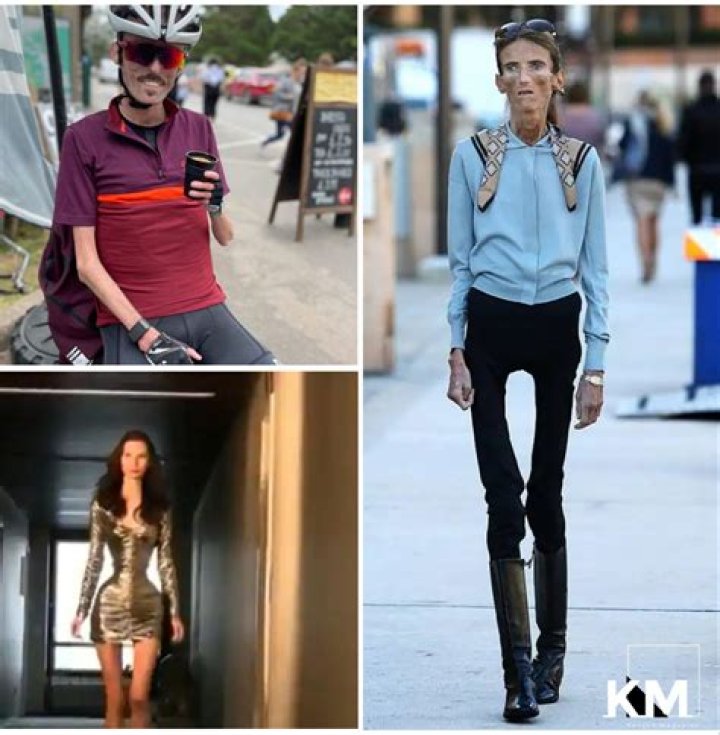 Top 10 Skinniest People In The World 2022 Kenyan Magazine