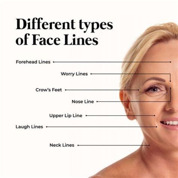 Types Of Lines On Face (Wrinkles) Glam Skin Review