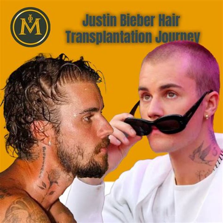 Unveiling The Journey Of Justin Bieber: AHE