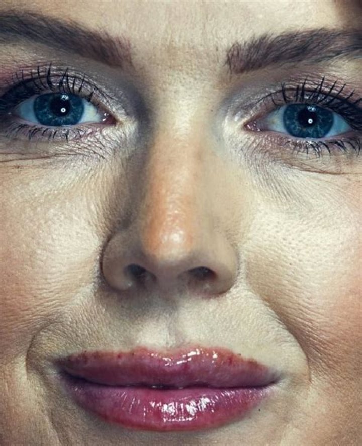Vanity Fair and Leanne Support Award