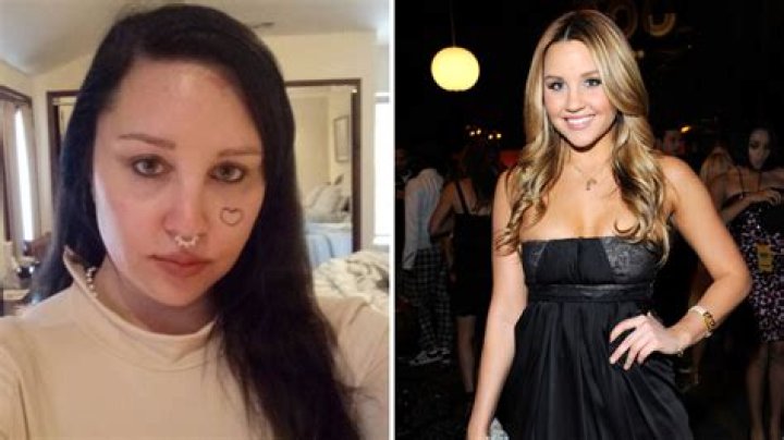 Video Amanda Bynes speaks out about her mental breakdown ABC News