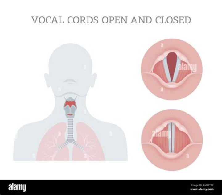 VOCAL