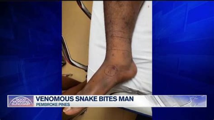 Warning Graphics Snake Bites Man in Face YouTube