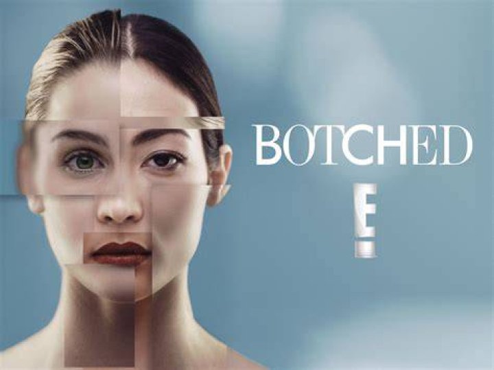 Watch Botched Episode Vagina Bomb!