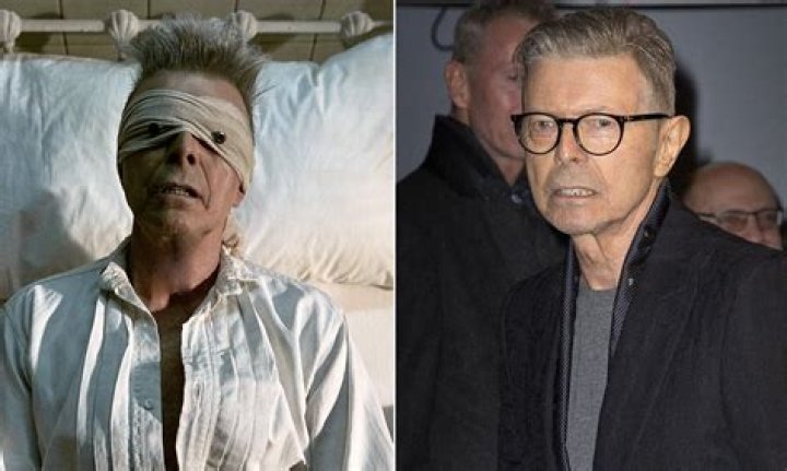 What Cancer Did David Bowie Die Of CancerWalls