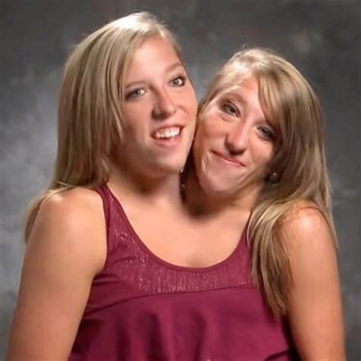 What Conjoined Twins Abby And Brittany Hensel Look Li vrogue.co