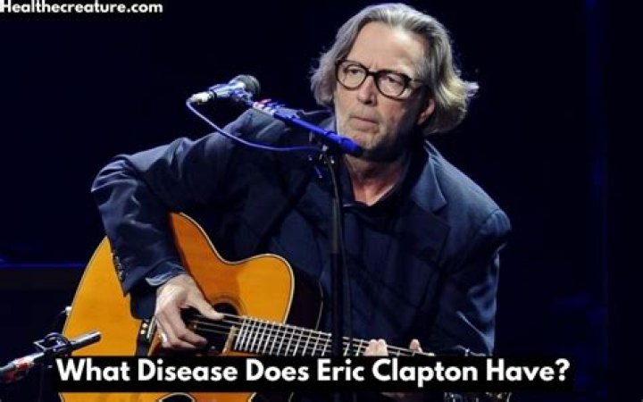 What Disease Does Eric Clapton Have? On Point Guitar