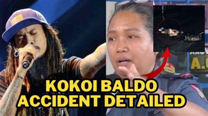 What Happened to Kokoi Baldo? Who is His Wife? Explore His Age and Career