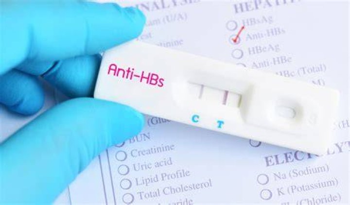 What is AntiHBS, what does positive and negative AntiHBS mean
