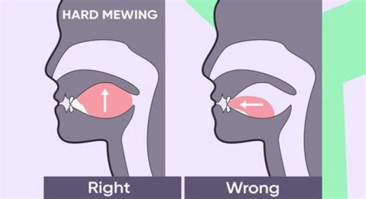 What Is Mogging And Mewing? YouTube