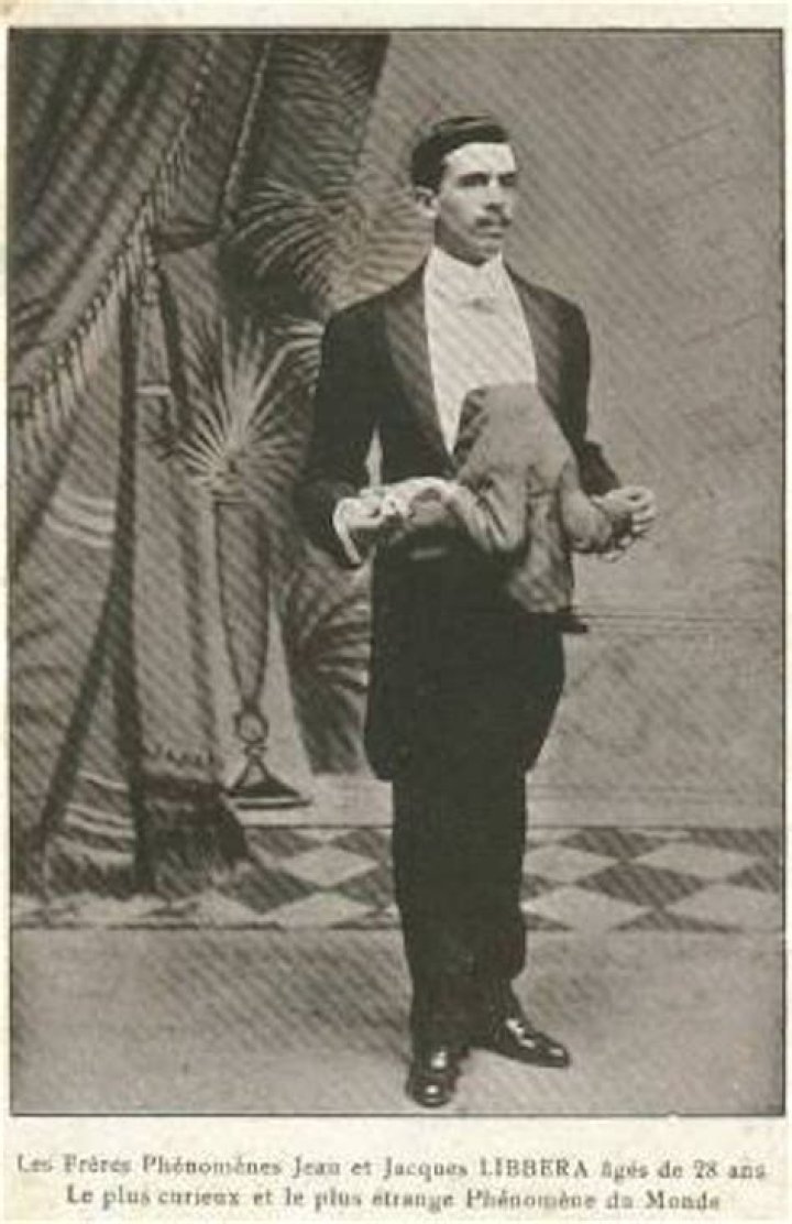 Who Was JeanJacques Libbera, The 'DoubleBodied Man'?