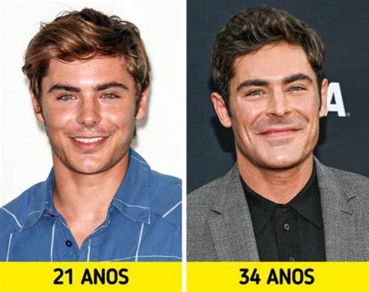 Zac Efron habl&oacute; los rumores de que se oper&oacute; la cara e hizo una dolorosa